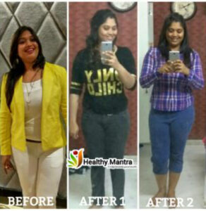 20171112_204353-300x300